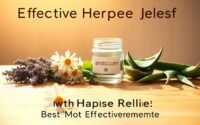 relieve herpes